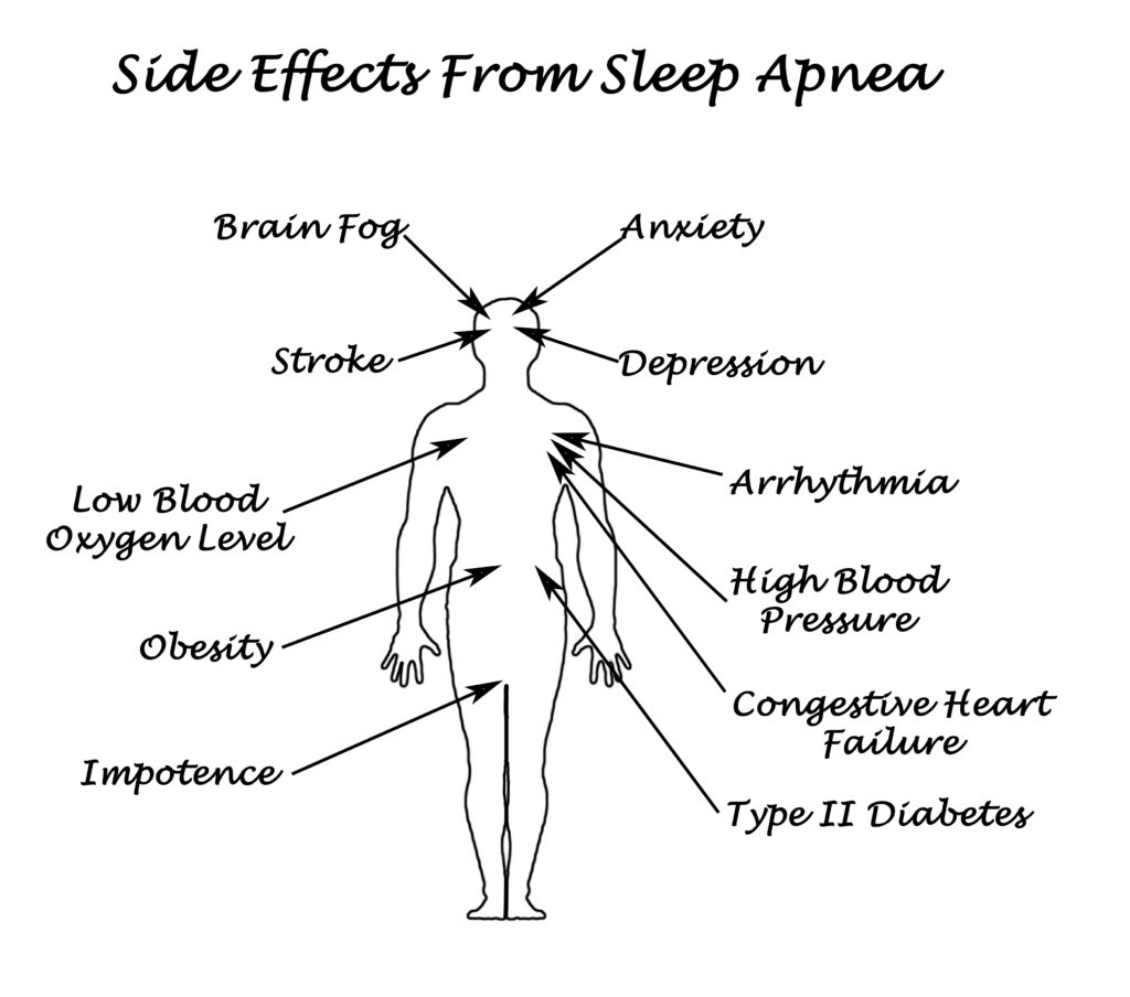 Sife Effects From Sleep Apnea