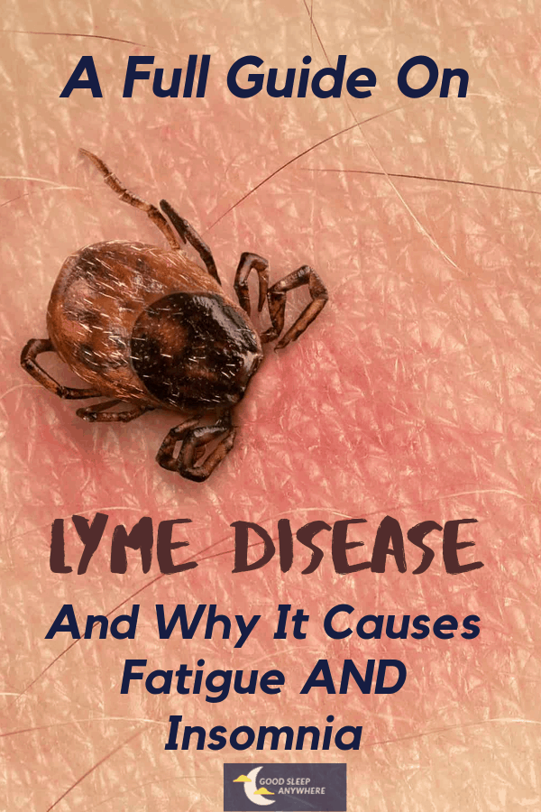 A full guide on Lyme disease